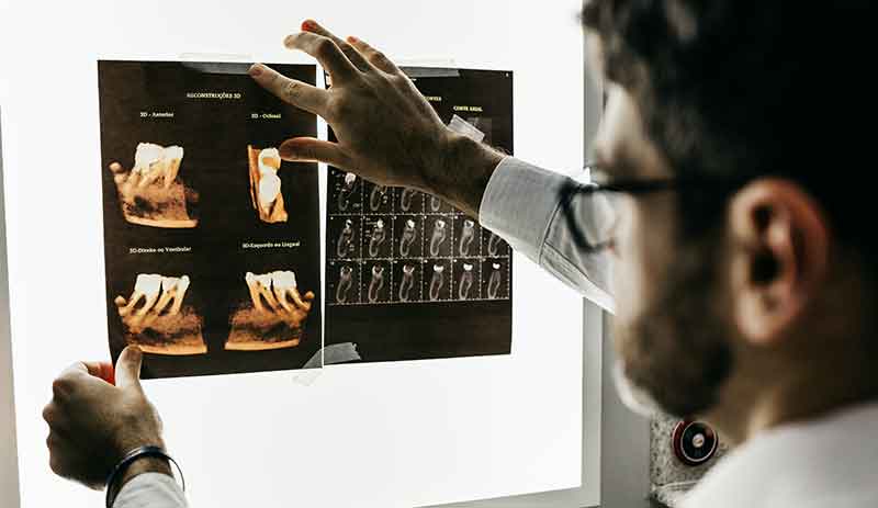 Dentist reviewing dental X-rays